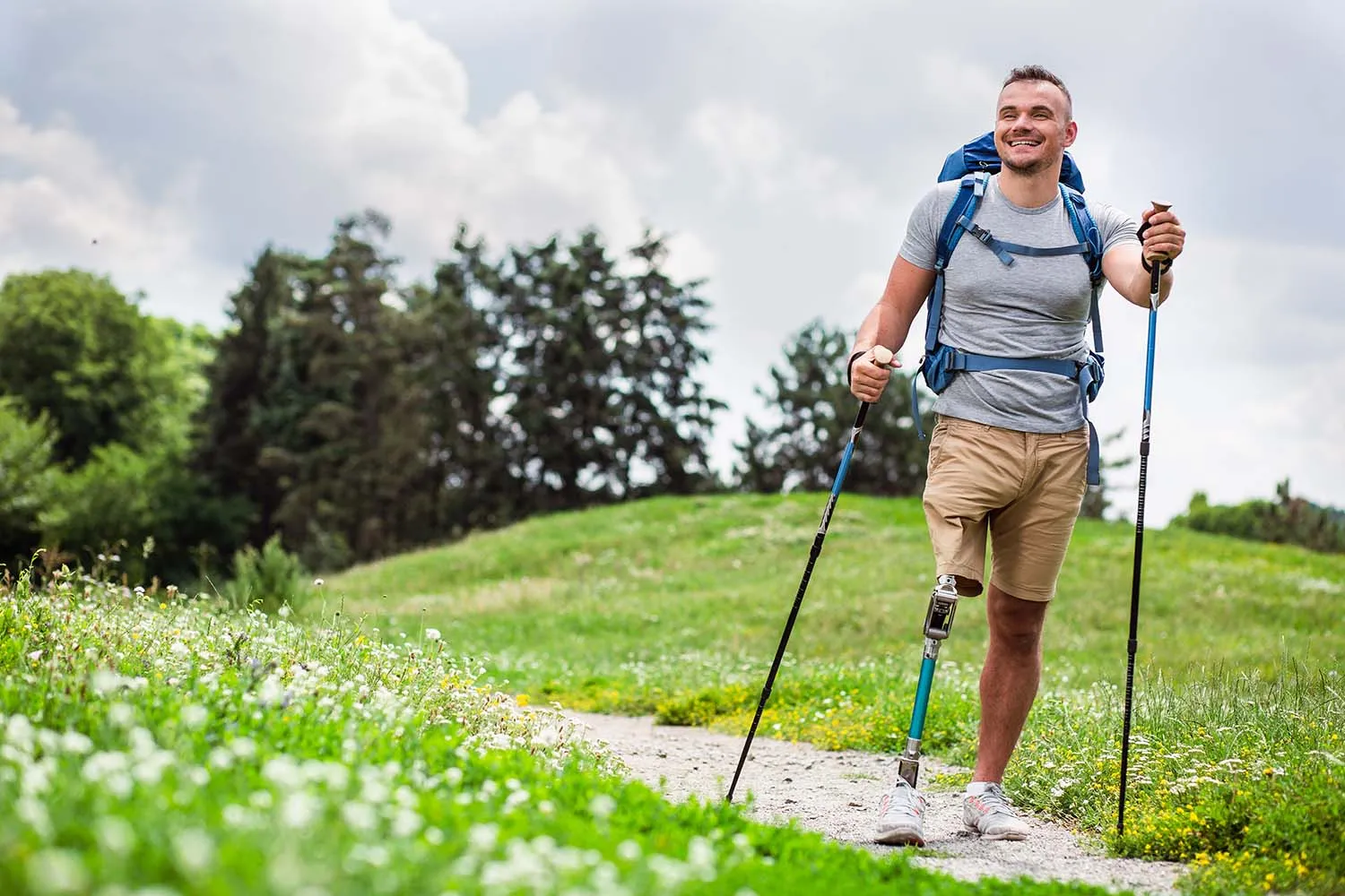 Full,Length,Of,A,Nice,Positive,Young,Man,With,Prosthesis